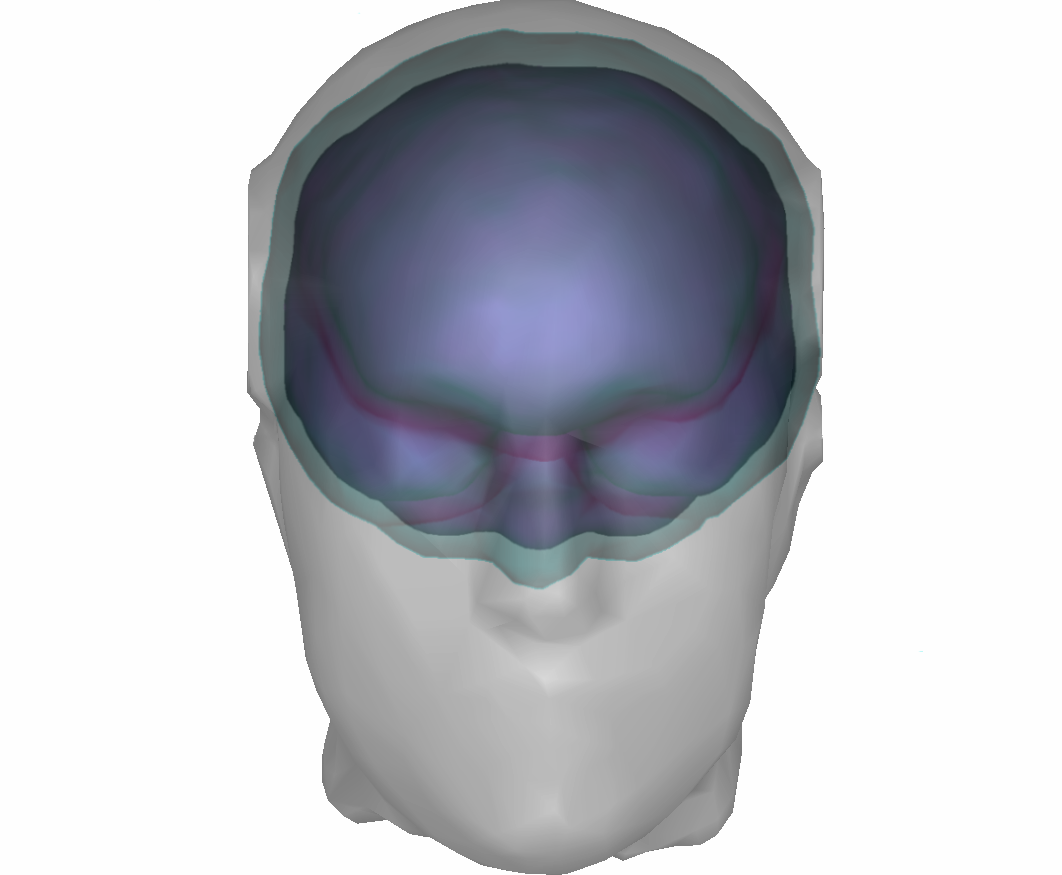 Example with three surfaces: outer scalp (gray),